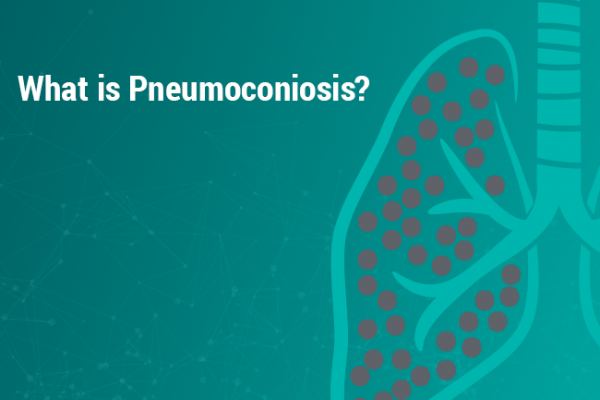 Pneumoconiosis